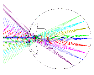 fig4-09TN.gif Eye Model shown out of <br>focus to illustrate the effect of a <br>2 mm thickness lens error on the images <br>of small stars focused on the retina 300x239