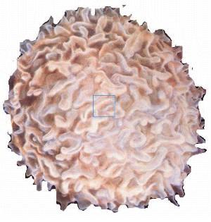 fig4-12TN.jpg One white blood cell (10 microns field of view)300x315