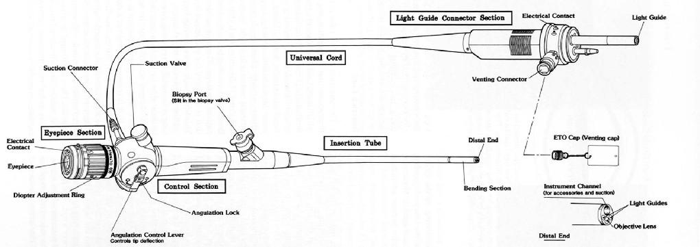 ovassapian airway