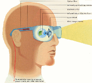 fig5-24TN.gif Toward an artificial eye 300x272