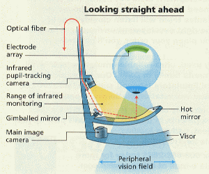 fig5-25TN.gif Details of an Implanted Array in the retina and supporting Camera System 300x250