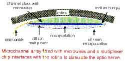 fig5-26eTN.jpg Potential Retina Implant 250x123